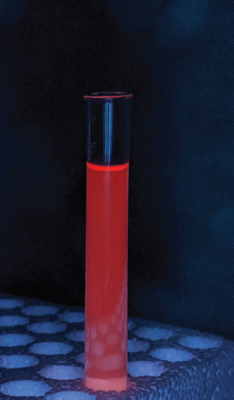 Wood's lamp photograph of the patient's urine demonstrating red-orange fluorescence.